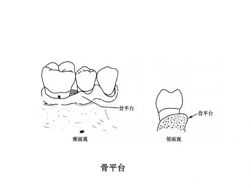 牙周病学第四版4