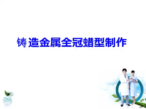 铸造金属全冠蜡型制作