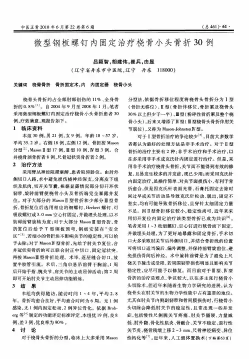 微型钢板螺钉内固定治疗桡骨小头骨折30例