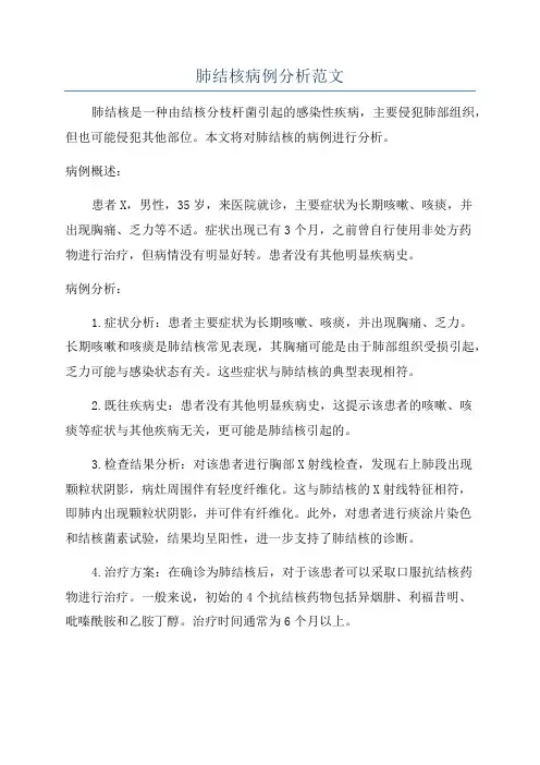 肺结核病例分析范文