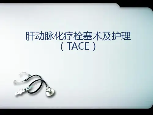 肝动脉化疗栓塞术(TACE)-PPT