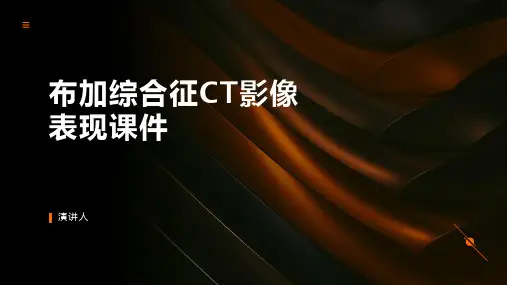 布加综合征CT影像表现课件