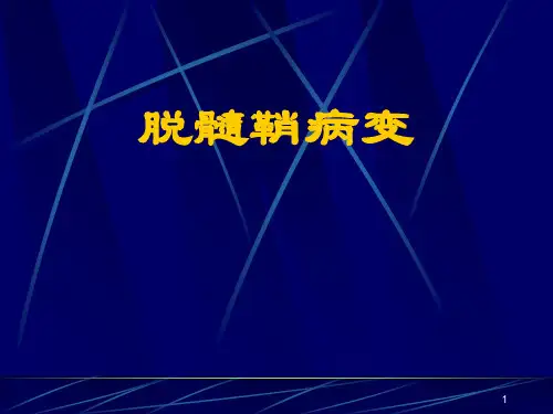 脱髓鞘病变ppt课件