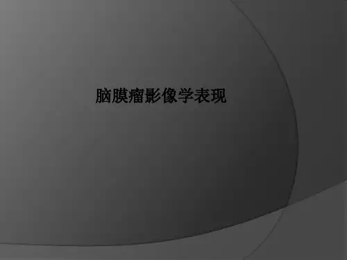 脑膜瘤影像学表现