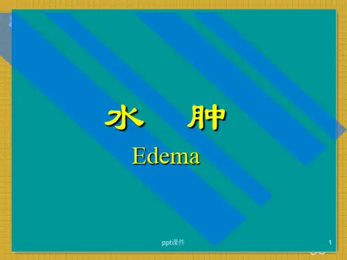 诊断学水肿 ppt课件