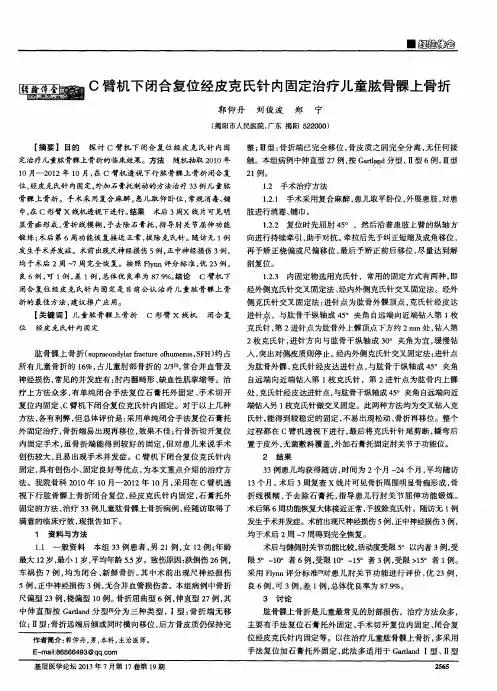 C臂机下闭合复位经皮克氏针内固定治疗儿童肱骨髁上骨折