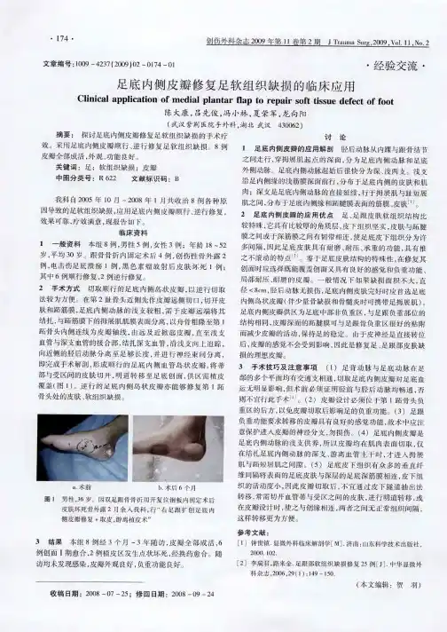 足底内侧皮瓣修复足软组织缺损的临床应用