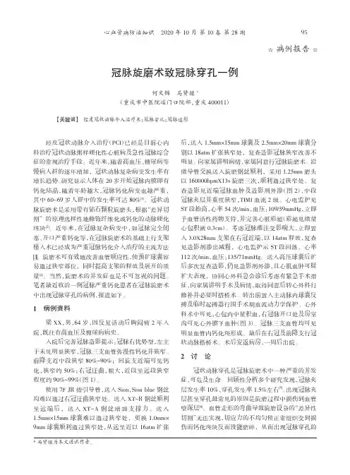 冠脉旋磨术致冠脉穿孔一例