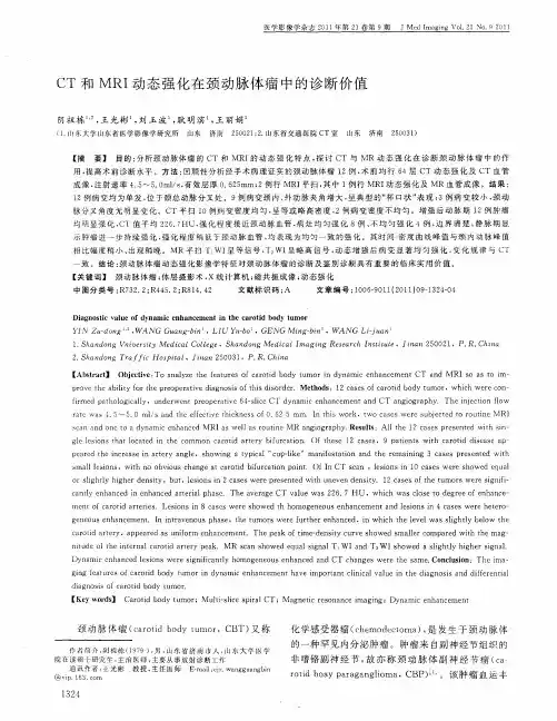 CT和MRI动态强化在颈动脉体瘤中的诊断价值