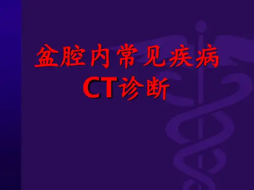 盆腔内常见疾病CT诊断ppt课件