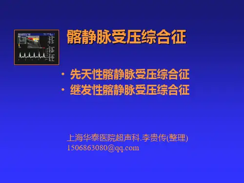 髂静脉受压综合征汇总.