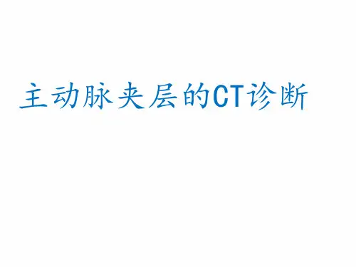 主动脉夹层CT诊断与鉴别