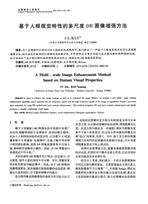 基于人眼视觉特性的多尺度DR图像增强方法