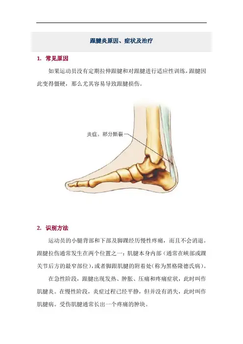 跟腱炎原因、症状及治疗