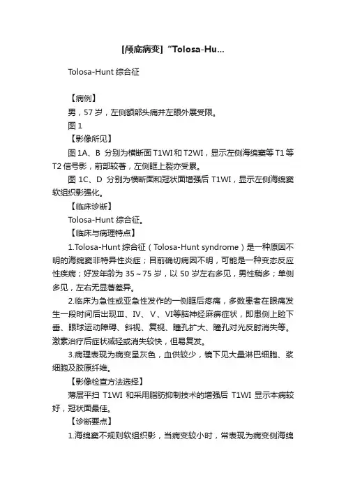 [颅底病变]“Tolosa-Hu...