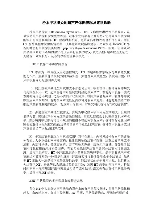 桥本甲状腺炎的超声声像图表现及鉴别诊断