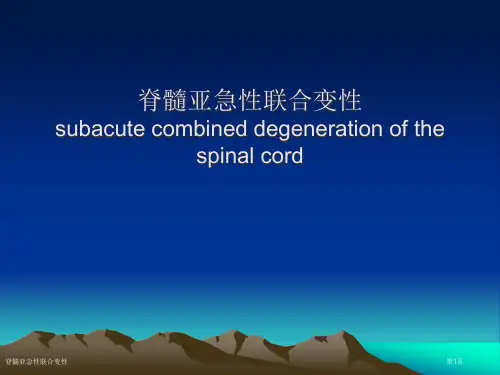 脊髓亚急性联合变性