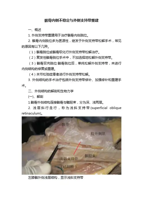 髌骨内侧不稳定与外侧支持带重建