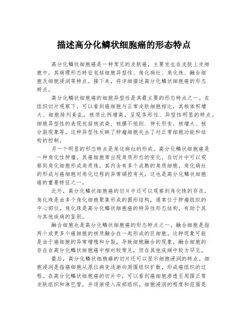 描述高分化鳞状细胞癌的形态特点