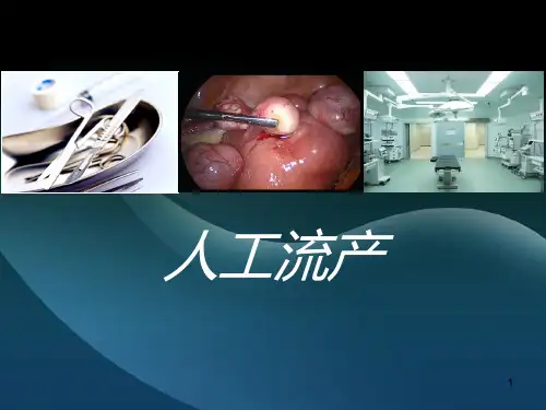 人工流产PPT课件