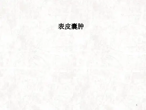 表皮囊肿ppt演示课件