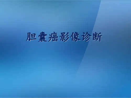胆囊癌CT及MR诊断