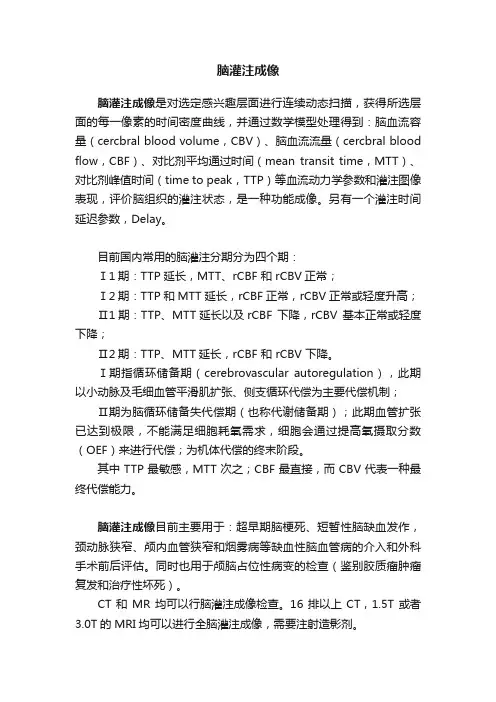 脑灌注成像