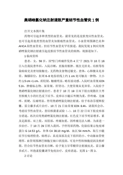 奥硝唑氯化钠注射液致严重结节性血管炎1例
