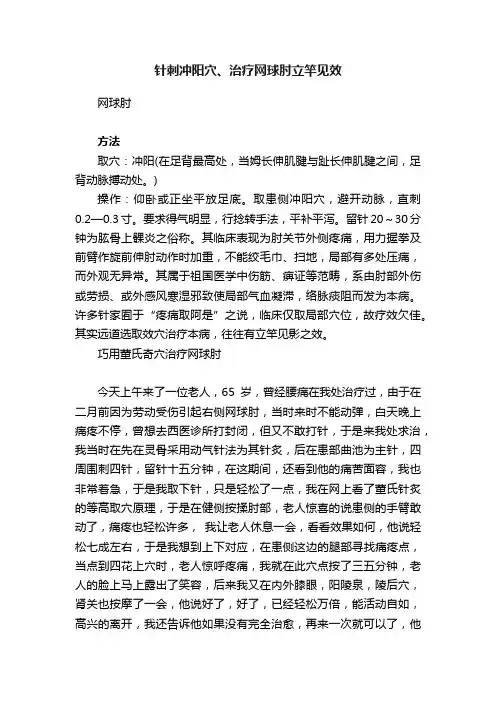 针刺冲阳穴、治疗网球肘立竿见效