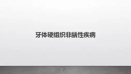 牙体硬组织非龋性疾病