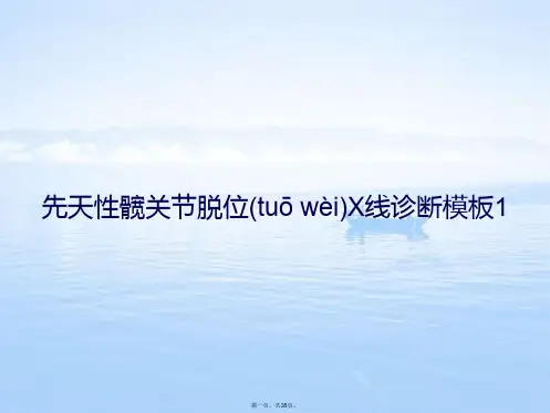 先天性髋关节脱位X线诊断模板