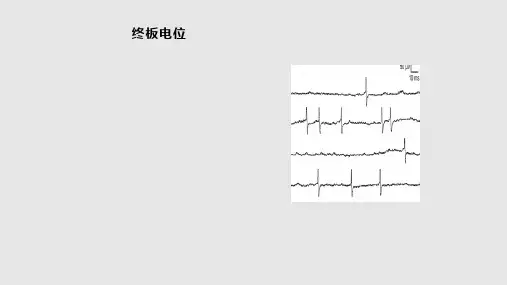 肌电图基础知识之电位分析分析