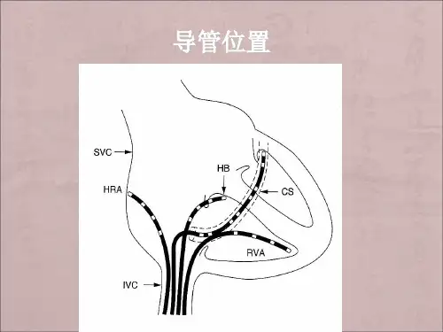 心脏电生理检查的基础知识  2月份PPT幻灯片