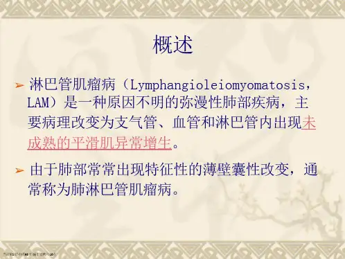 肺淋巴管肌瘤病的临床及CT表现