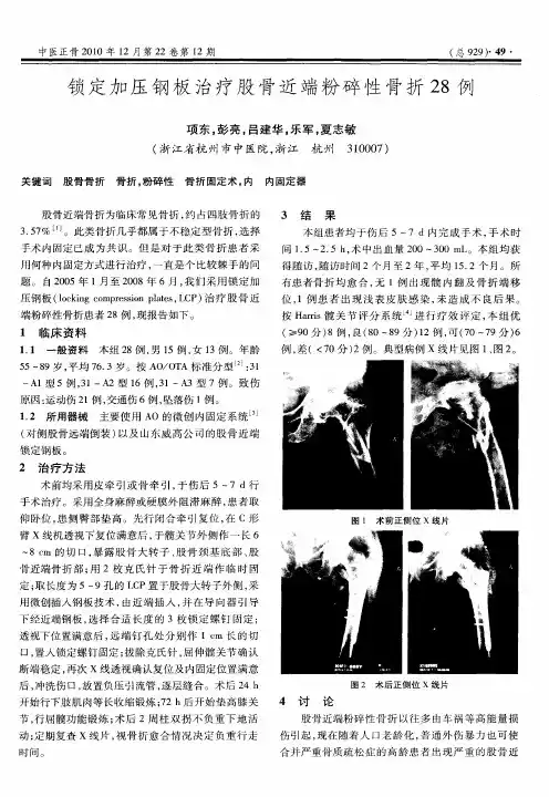 锁定加压钢板治疗股骨近端粉碎性骨折28例