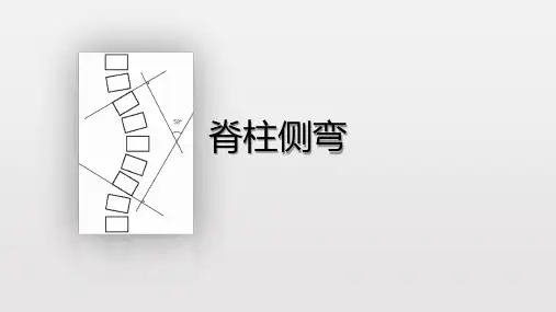 脊柱侧弯康复