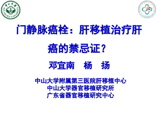 门静脉癌栓：肝移植治疗肝癌的禁忌证？