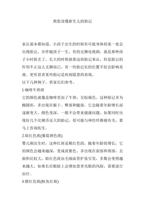 教您读懂新生儿的胎记