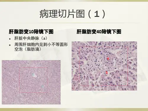 病例切片图(1)