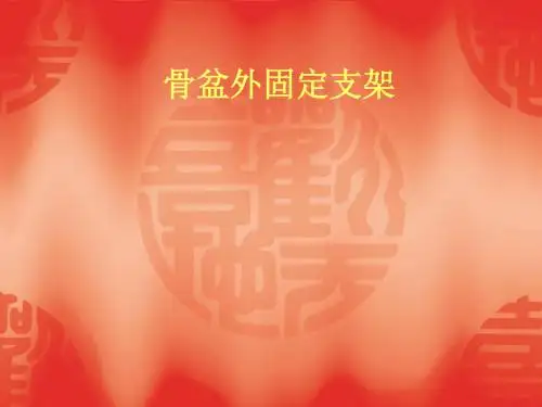 骨盆型外固定架
