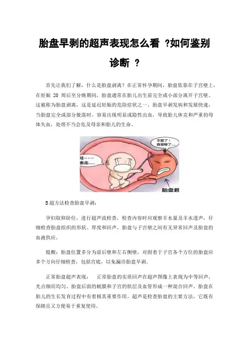胎盘早剥的超声表现怎么看?如何鉴别诊断?