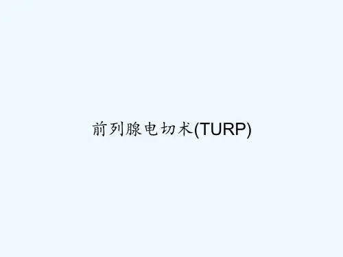 前列腺电切术(TURP)-PPT