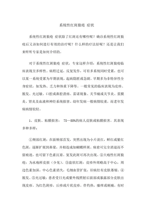 系统性红斑狼疮 症状