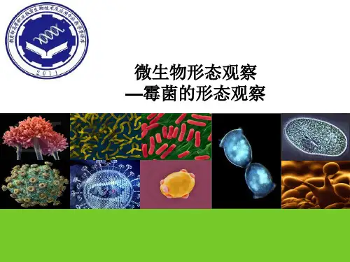 教学课件-霉菌形态观察.