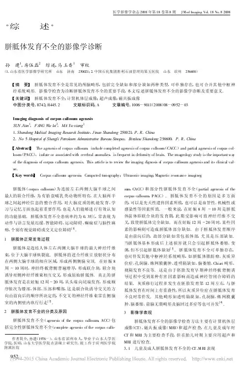 胼胝体发育不全的影像学诊断_孙建