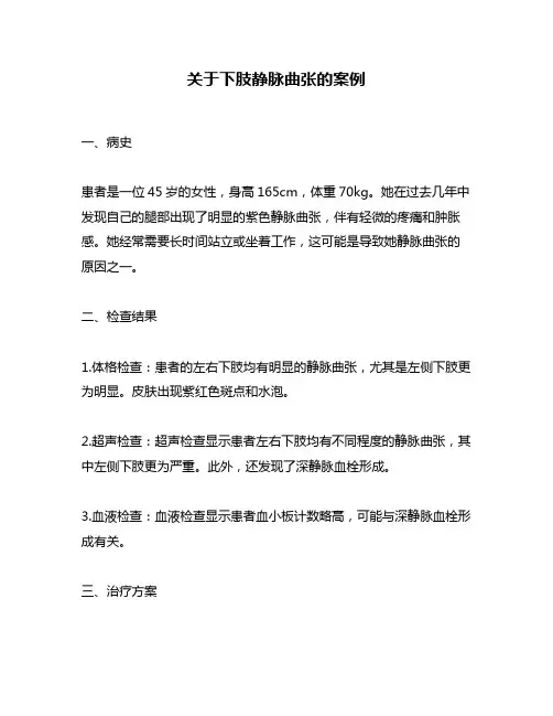 关于下肢静脉曲张的案例