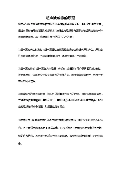 超声波成像的原理