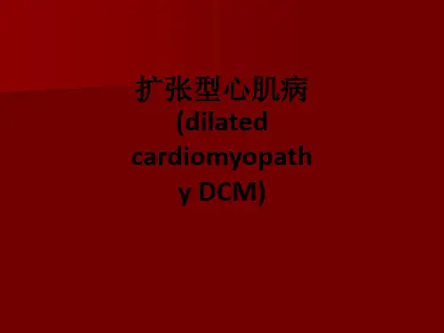 扩张型心肌病(dilated cardiomyopathy DCM)ppt课件