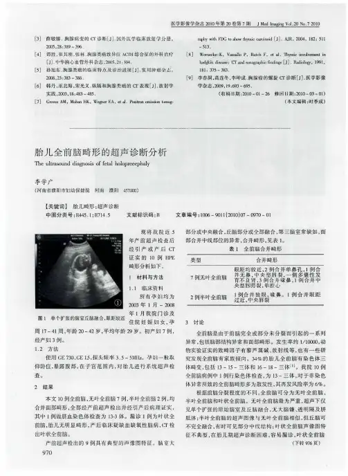 胎儿全前脑畸形的超声诊断分析