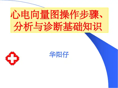 心电图-心电向量图 图解